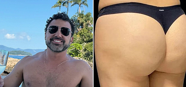 Lékař si říká král celulitidy. Ženám vylepšuje pozadí bez operace