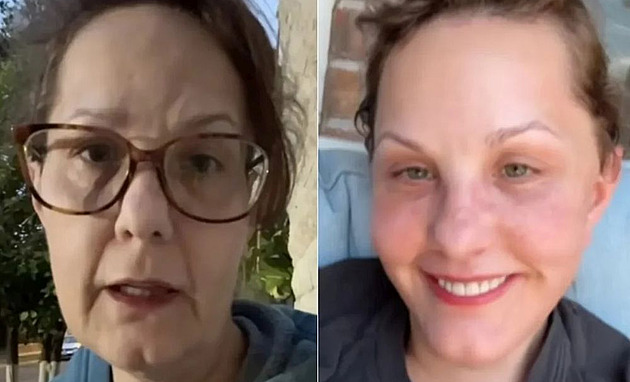 Žena díky faceliftu extrémně omládla, lidé jsou z proměny nadšení
